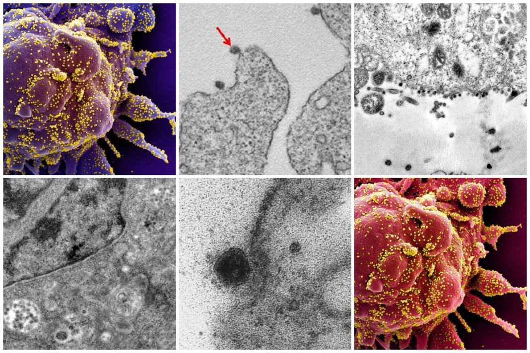the-moment-coronavirus-infects-a-healthy-cell-captured-under-microscope