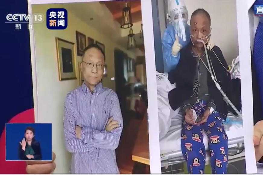chinese-doctor-whose-skin-turned-dark-after-catching-coronavirus-sees-original-colour-return