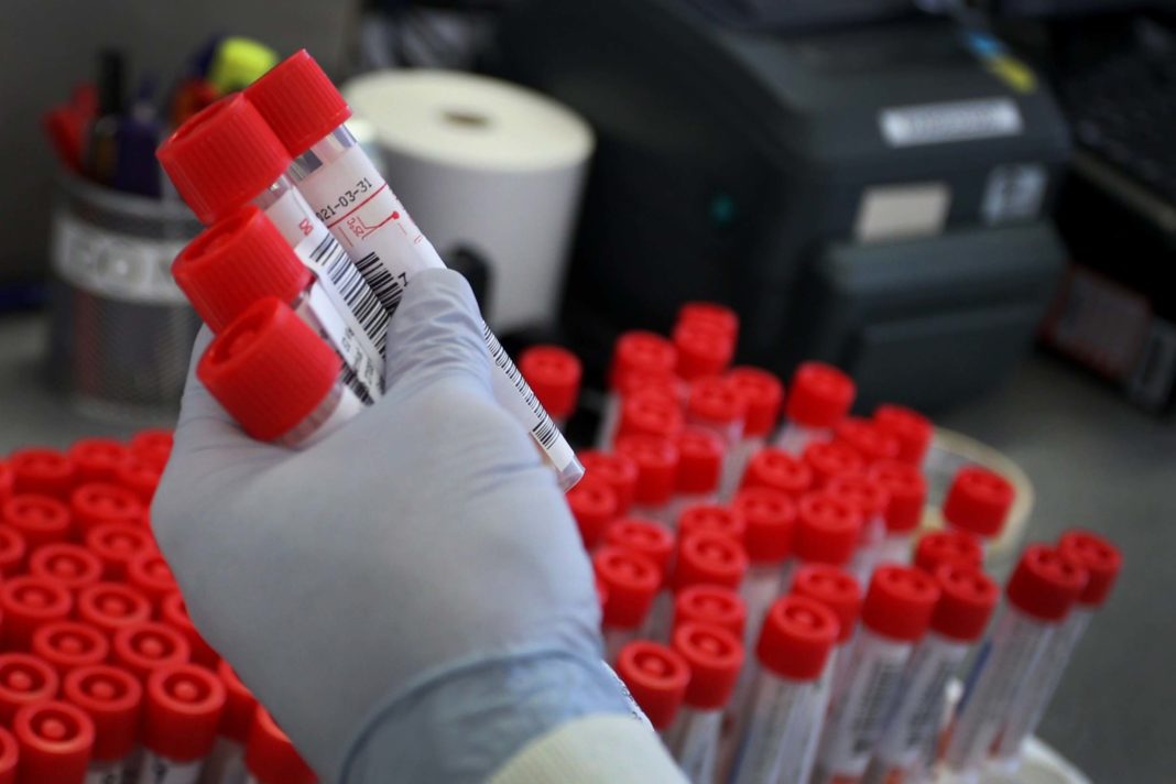 how-do-coronavirus-home-tests-work?