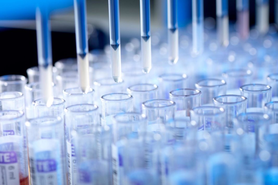 superdrug-is-selling-the-coronavirus-antibody-test-for-69