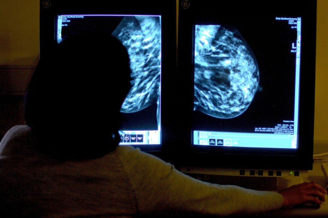 one-million-women-have-missed-breast-cancer-screening-due-to-pandemic,-charity-warns