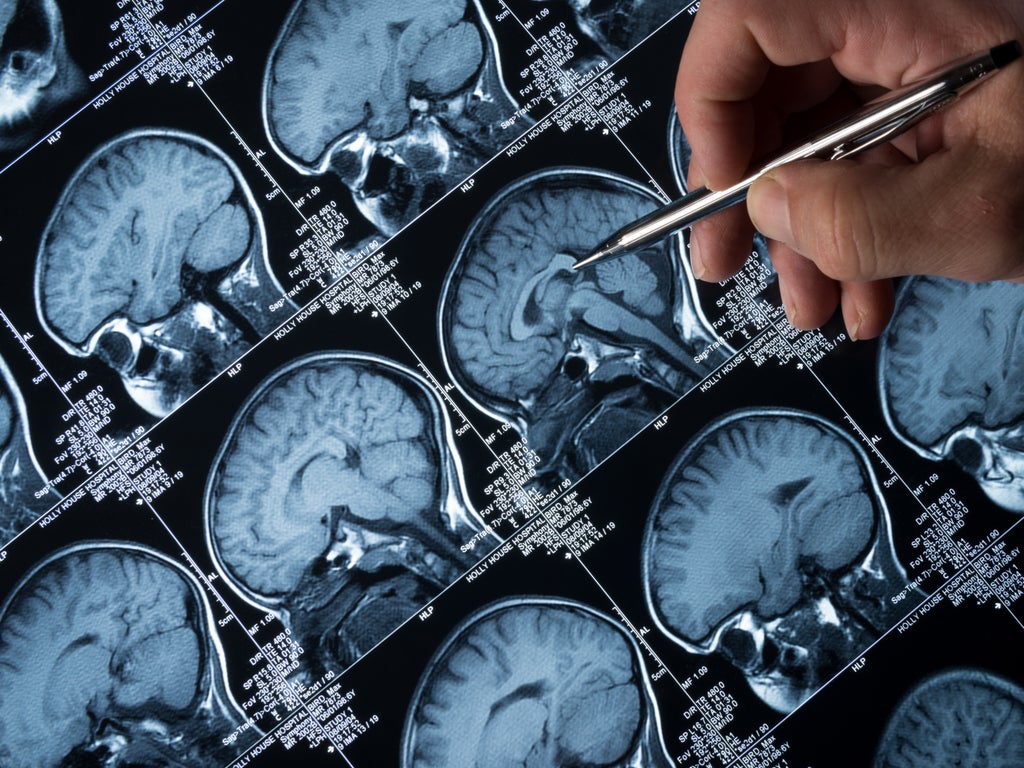 oxygen-therapy-may-slow-alzheimer’s,-study-finds