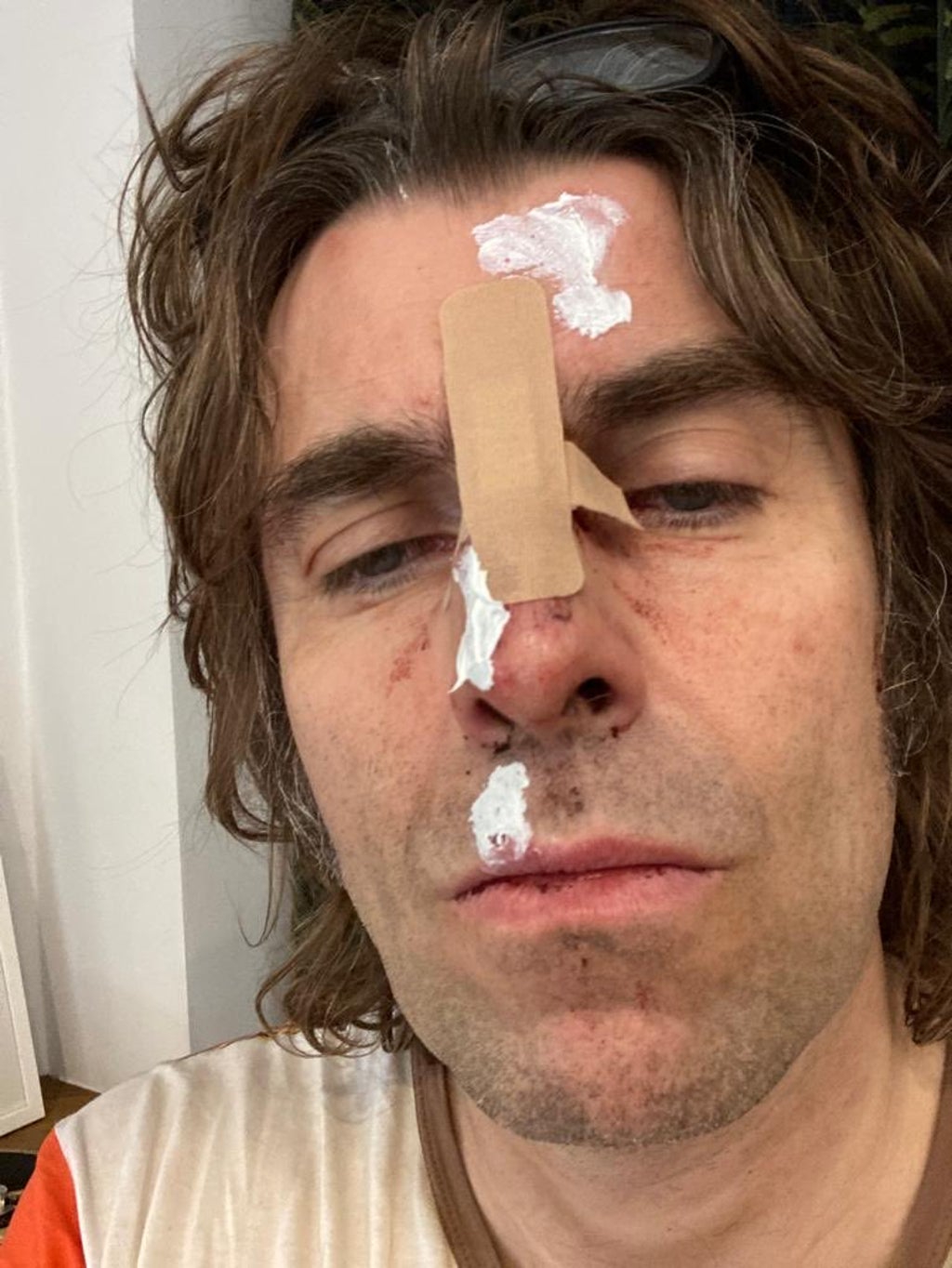 liam-gallagher-injured-‘falling-from-a-helicopter’-after-headlining-isle-of-white-festival