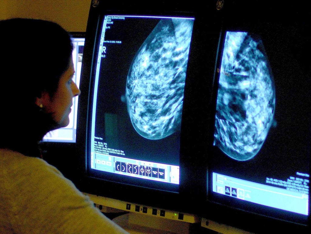 breast-cancer-drug-‘found-to-reduce-risk-of-disease-progression’