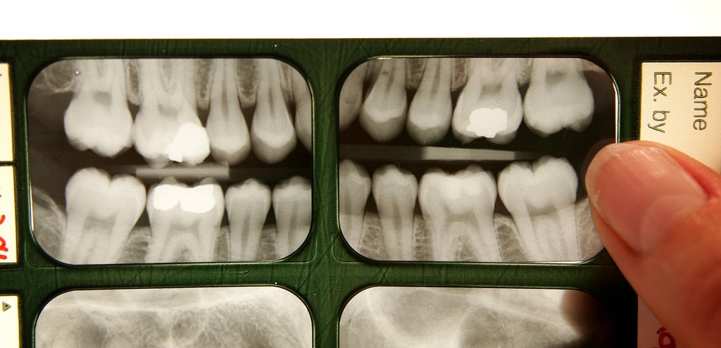 primate-skull-study-sheds-light-on-why-wisdom-teeth-grow-so-late-in-humans