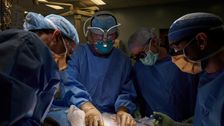 groundbreaking-new-test-brings-pig-to-human-kidney-transplants-a-step-closer