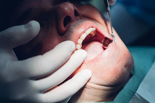 how-to-increase-the-number-of-patients-for-your-dental-clinic