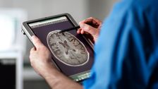 boston-man-suffers-seizures-caused-by-tapeworms-in-his-brain