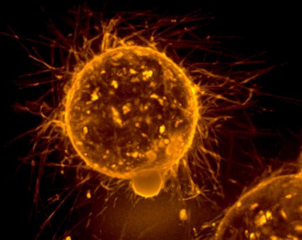 cancer-cells-strengthen-by-sucking-mitochondria-out-of-immune-cells-using-‘tiny-tentacles’,-study-finds