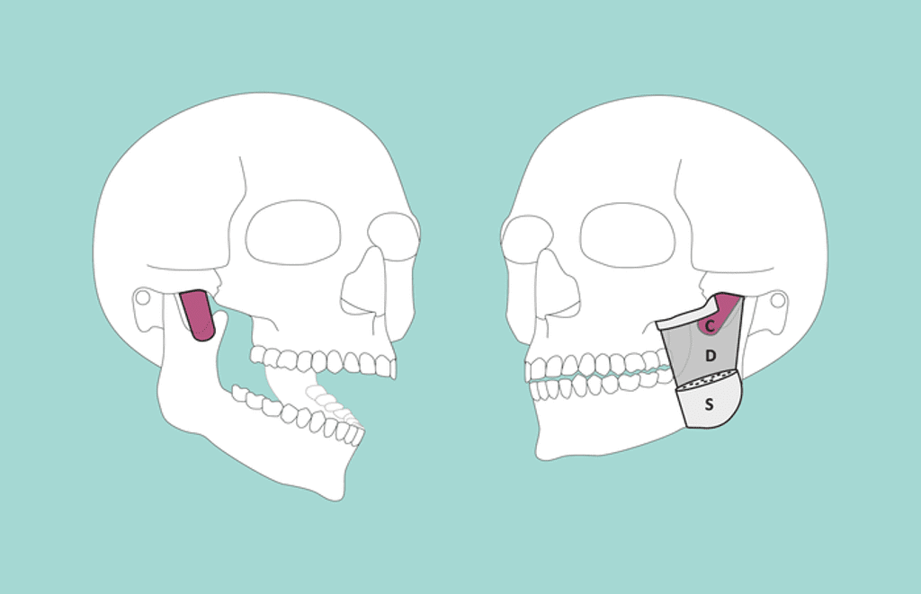 scientists-identify-whole-new-muscle-layer-in-human-jaw