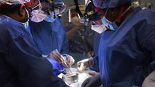 hospital-defends-transplanting-pig-heart-into-patient-with-criminal-past