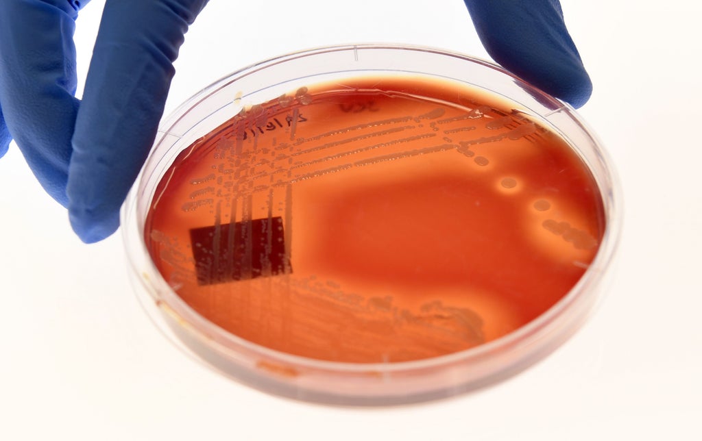 antibiotic-resistant-superbugs-caused-1.2-million-deaths-in-a-year,-study-finds