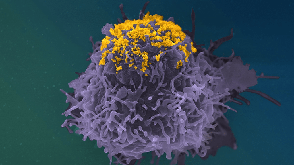 scientists-find-new-more-infectious-and-damaging-hiv-variant-in-the-netherlands