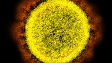 pandemics-are-expensive-preventing-them-is-cheap.
