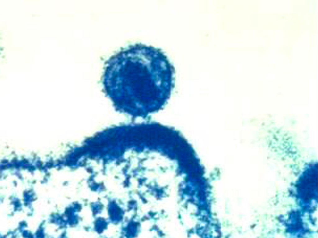 woman-is-cured-of-hiv-in-huge-breakthrough-for-virus-treatment
