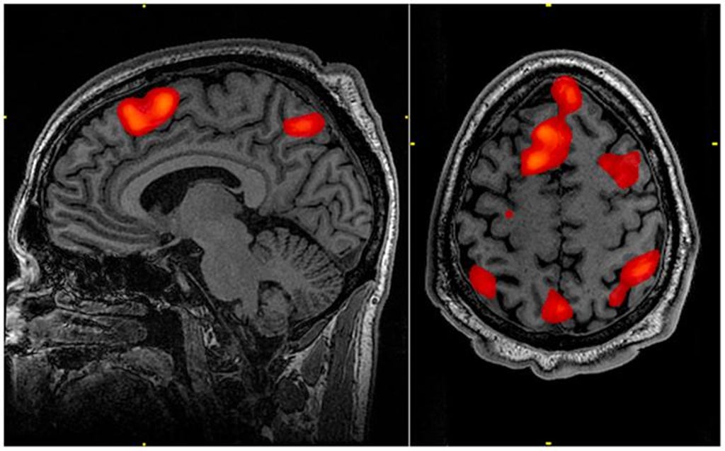life-really-does-flash-before-our-eyes-at-point-of-death,-landmark-study-suggests