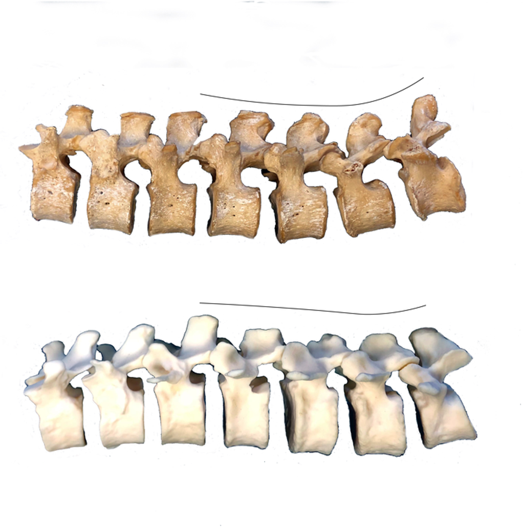 neanderthal-spine-study-sheds-light-on-back-pain-and-related-ailments-in-humans