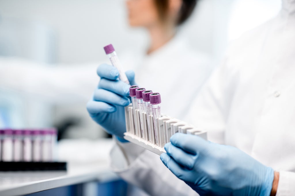 stool-samples-used-to-diagnose-pancreatic-cancer-in-patients