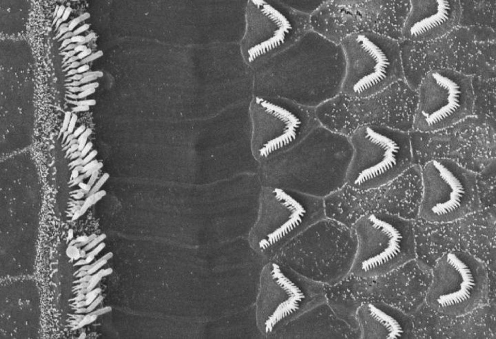 scientists-find-‘master-gene’-to-regrow-lost-ear-hair-cells-for-restoring-hearing-in-mice