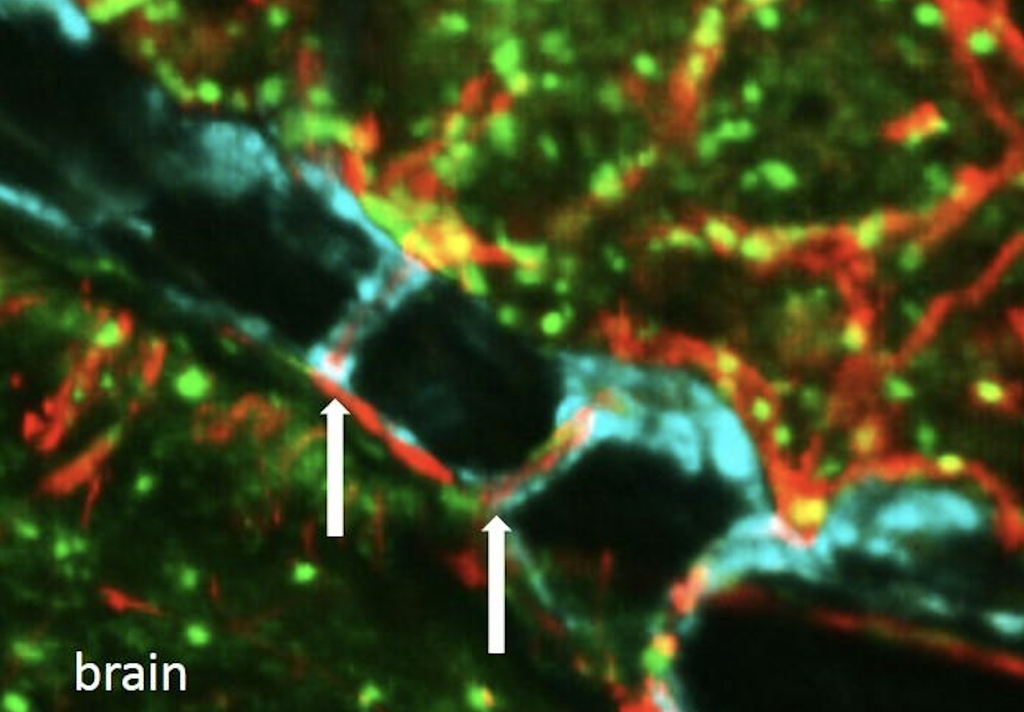 study-finds-tiny-channels-in-skull-that-could-play-‘vital-role’-in-brain-immunity