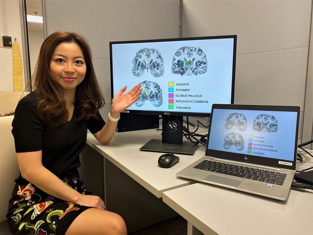 psychopaths-are-more-likely-to-have-larger-forebrain-region,-study-finds