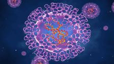 monkeypox:-what-you-need-to-know-about-the-virus