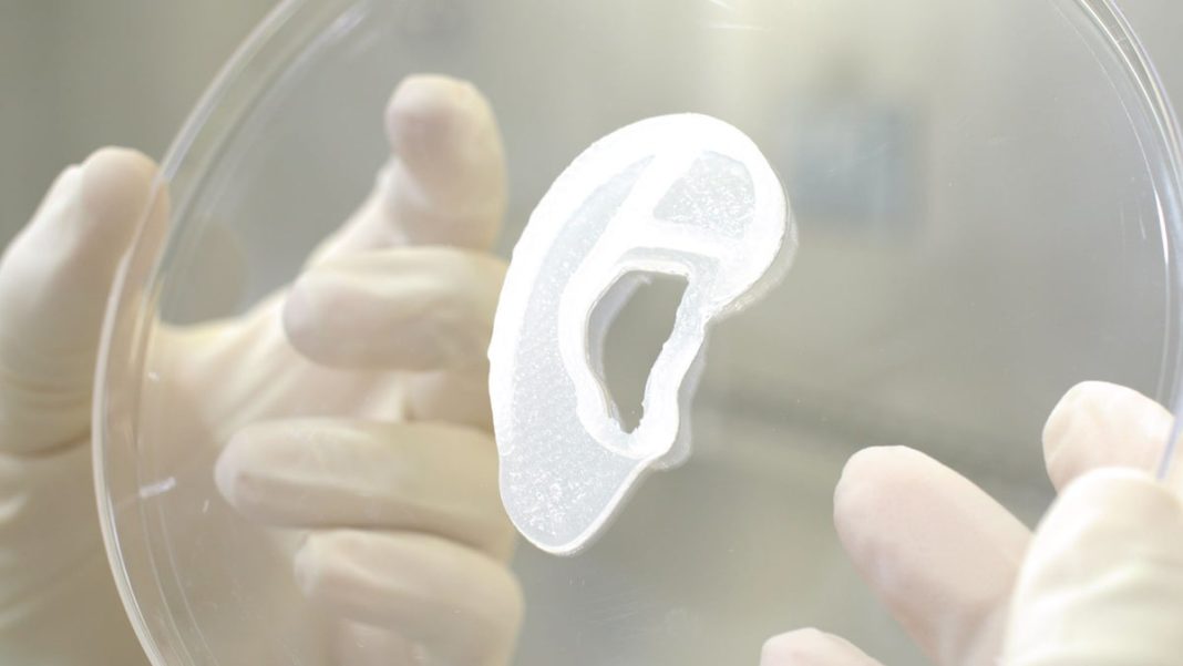 woman-receives-3d-printed-ear-implant-grown-from-her-own-cells-in-major-breakthrough