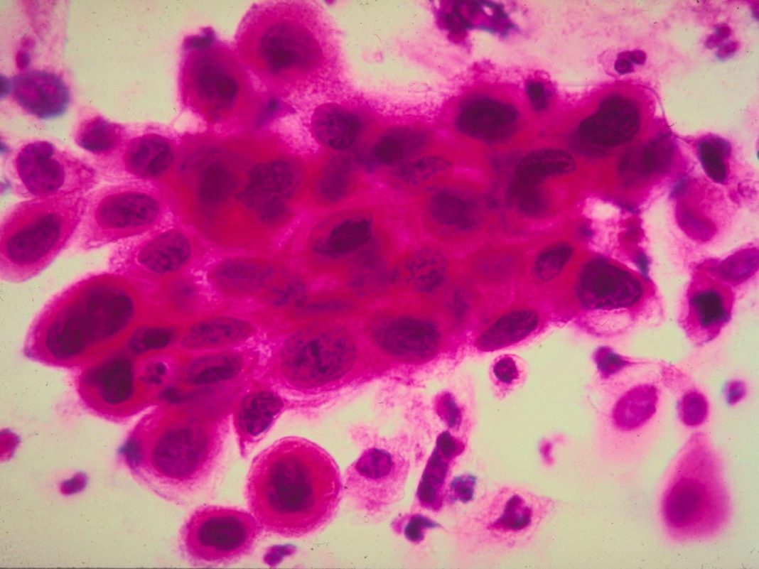 dostarlimab:-how-does-promising-cancer-drug-work?