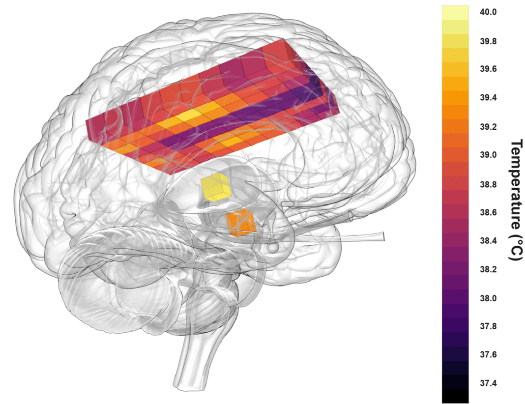 healthy-human-brains-are-hotter-than-previously-thought,-exceeding-40c-–-study