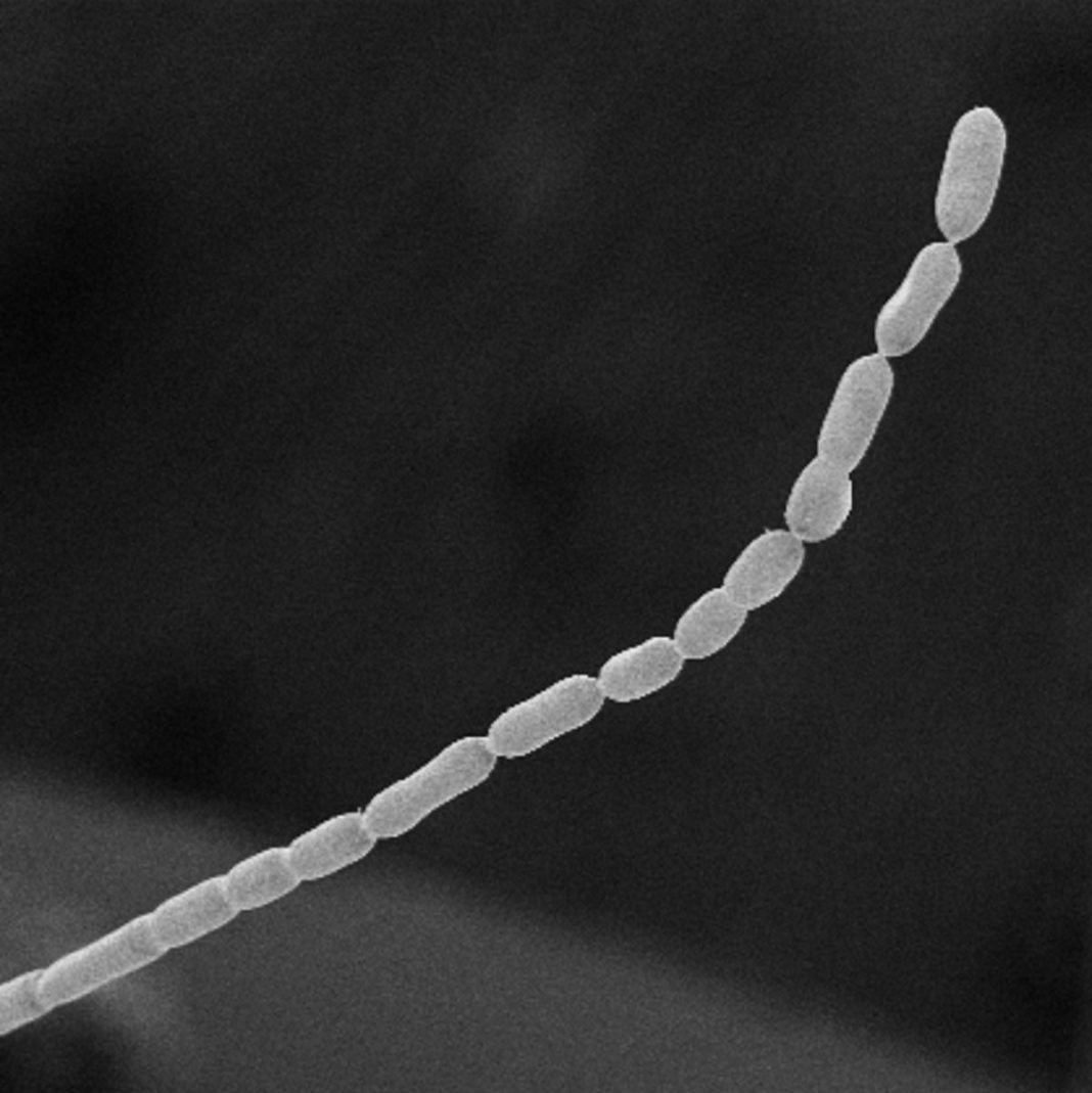 world’s-largest-bacterium-found-which-is-size-of-human-eyelash