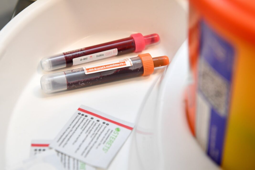 blood-test-could-predict-future-risk-of-leukaemia,-study-suggests