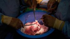 pig-organ-transplants-inch-closer-with-testing-in-the-dead