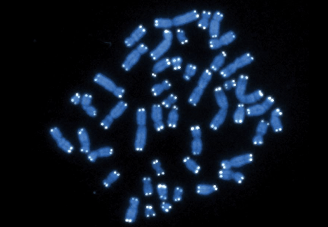 heart-disease-risk-rises-in-men-as-they-lose-y-chromosome-with-age,-study-finds