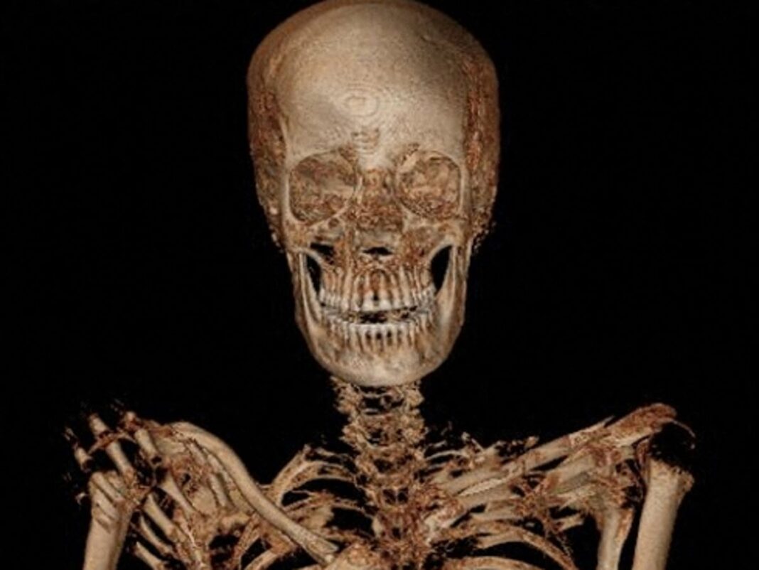 mysterious-‘pregnant’-egyptian-mummy-reveals-woman-may-have-also-had-cancer
