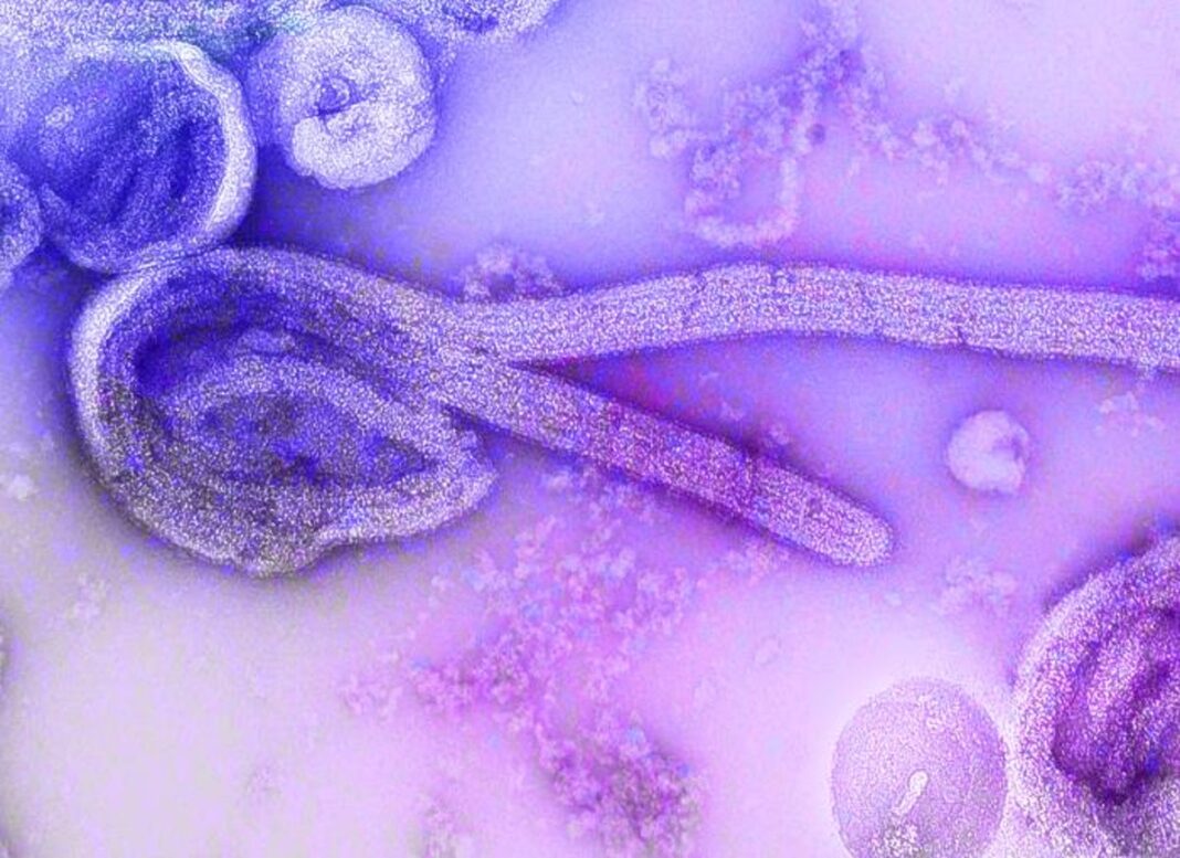 what-is-marburg-virus-and-how-does-it-spread?