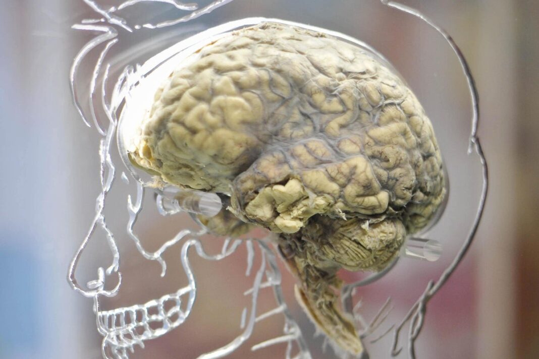 study-reveals-how-face-transplant-patient-recognises-new-appearance-as-their-own