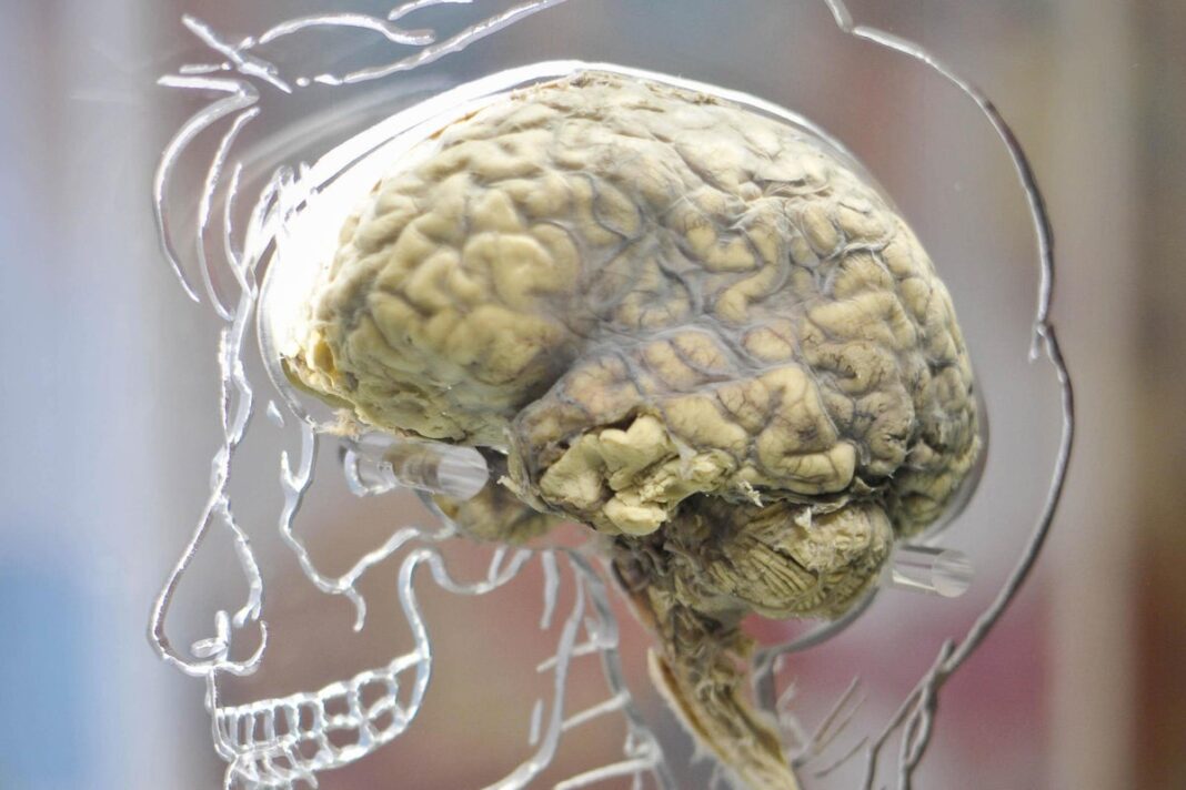 ‘45%-of-people-with-concussion-show-brain-injury-symptoms-six-months-later’