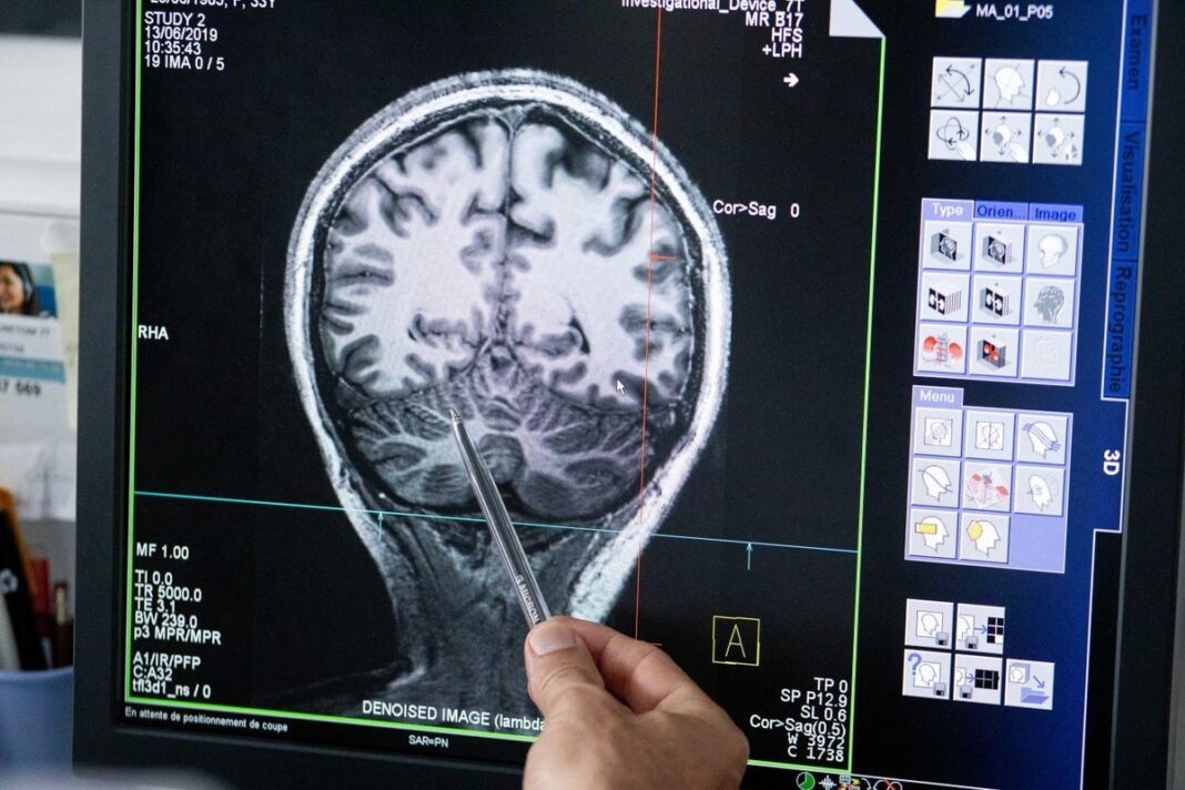 coma-patients-may-experience-fleeting-consciousness-seconds-before-death,-study-finds