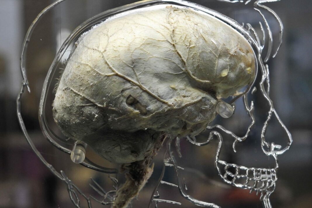 brain-signals-can-predict-how-much-pain-a-person-is-in,-research-suggests