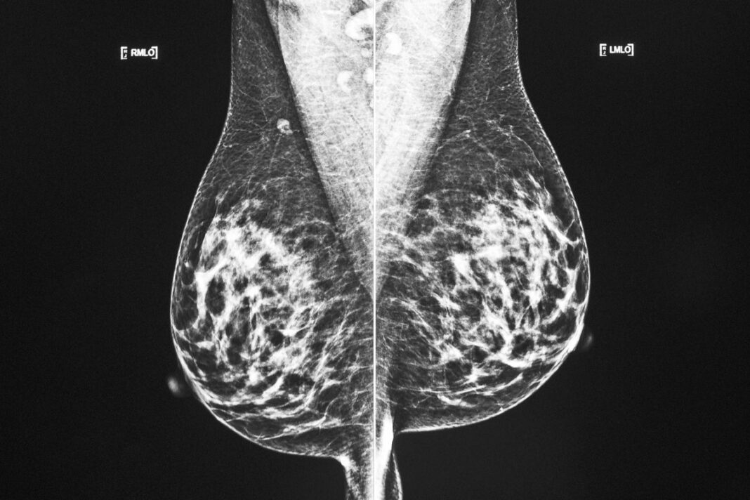 scientists-create-‘life-saving’-ai-that-predicts-if-cancer-will-spread