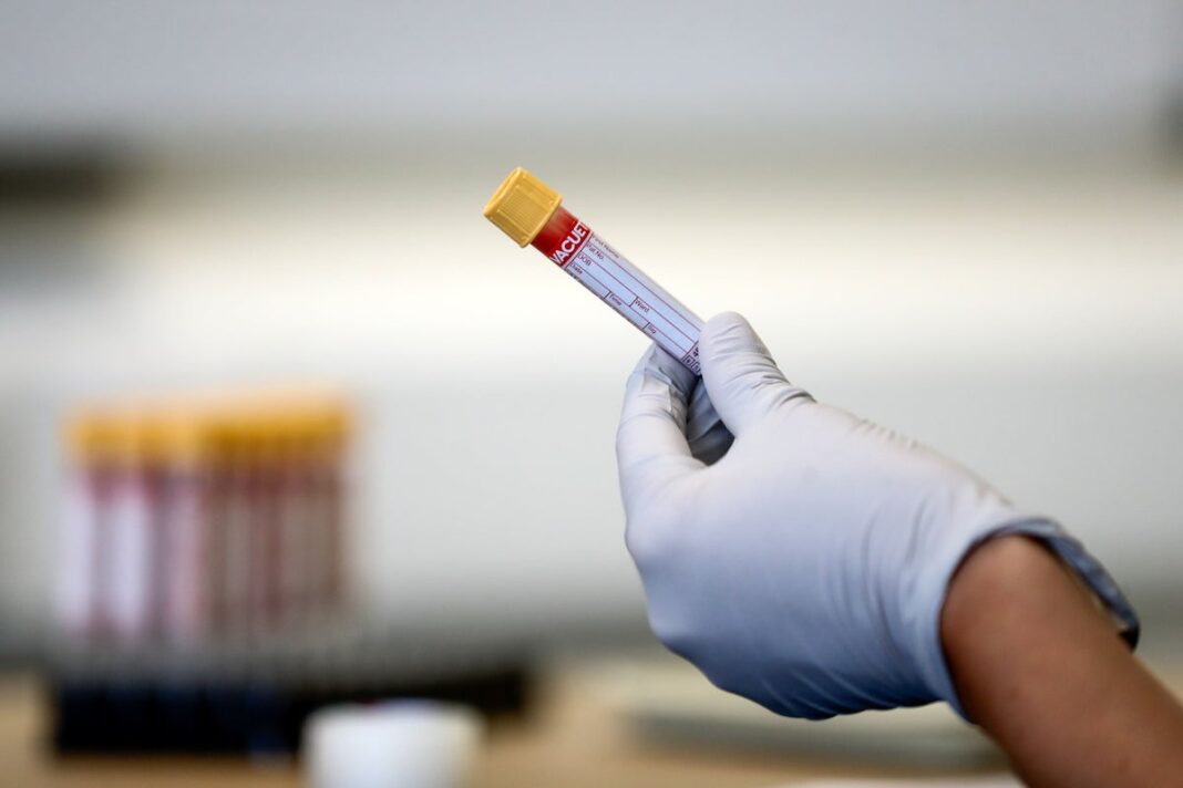 new-blood-test-for-50-types-of-cancer-sparks-hope-of-‘revolutionary’-breakthrough